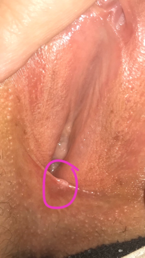 Небритая вагина с белыми выделениями фото