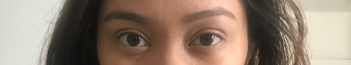 Woke Up With One Eye Smaller HELP PLS Eye Problems Forums Patient