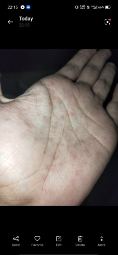 pinpoint red dots on skin not itchy