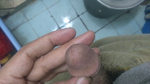 hole stings Penis
