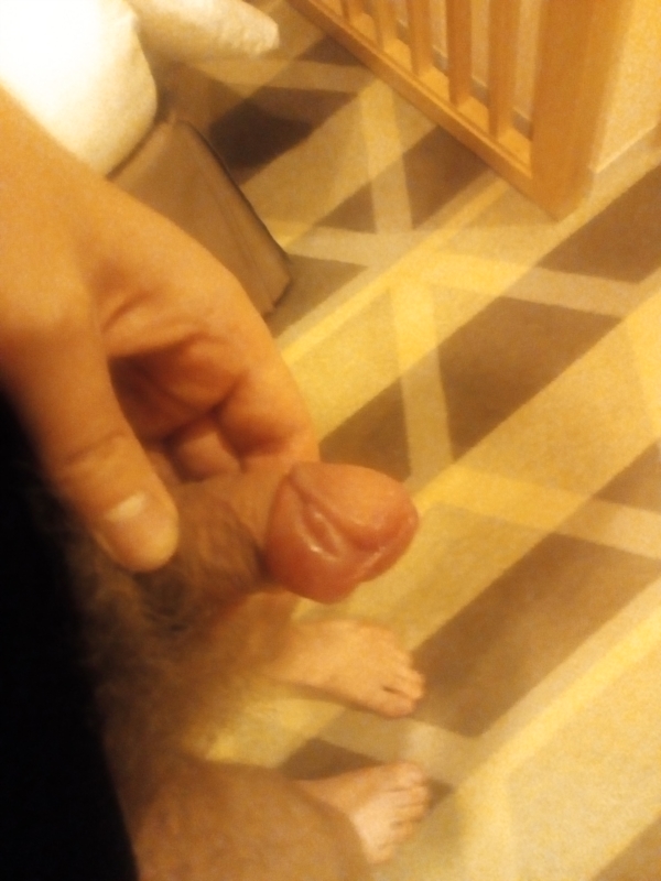 Swelling On The Penis 68