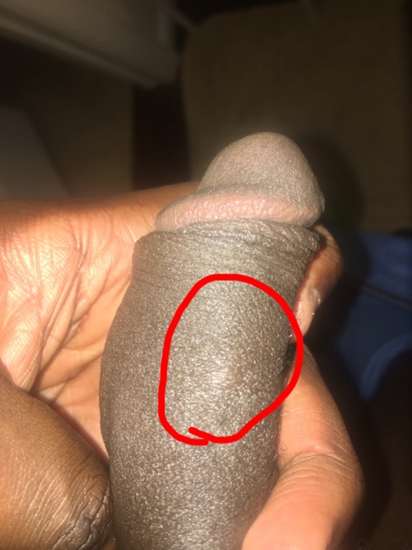 Penis Bumps