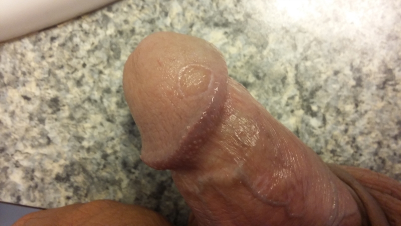 What Is This Substance On My Penis