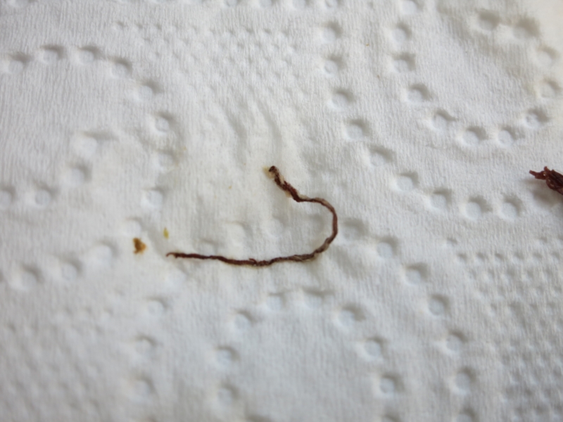Threadworms In Poop