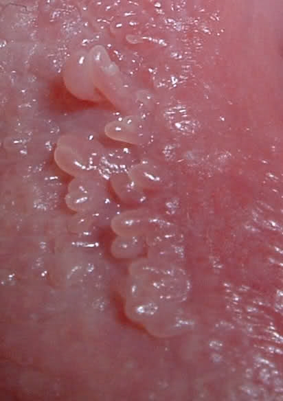 tratament cu paraziți orali helmintox nedir