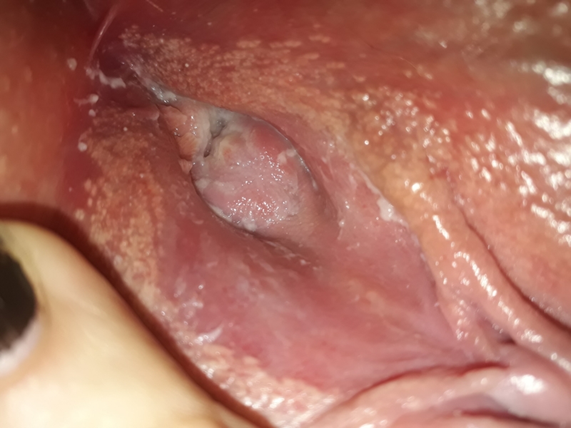 please help me understand whats going on inside my vagina? *picture.