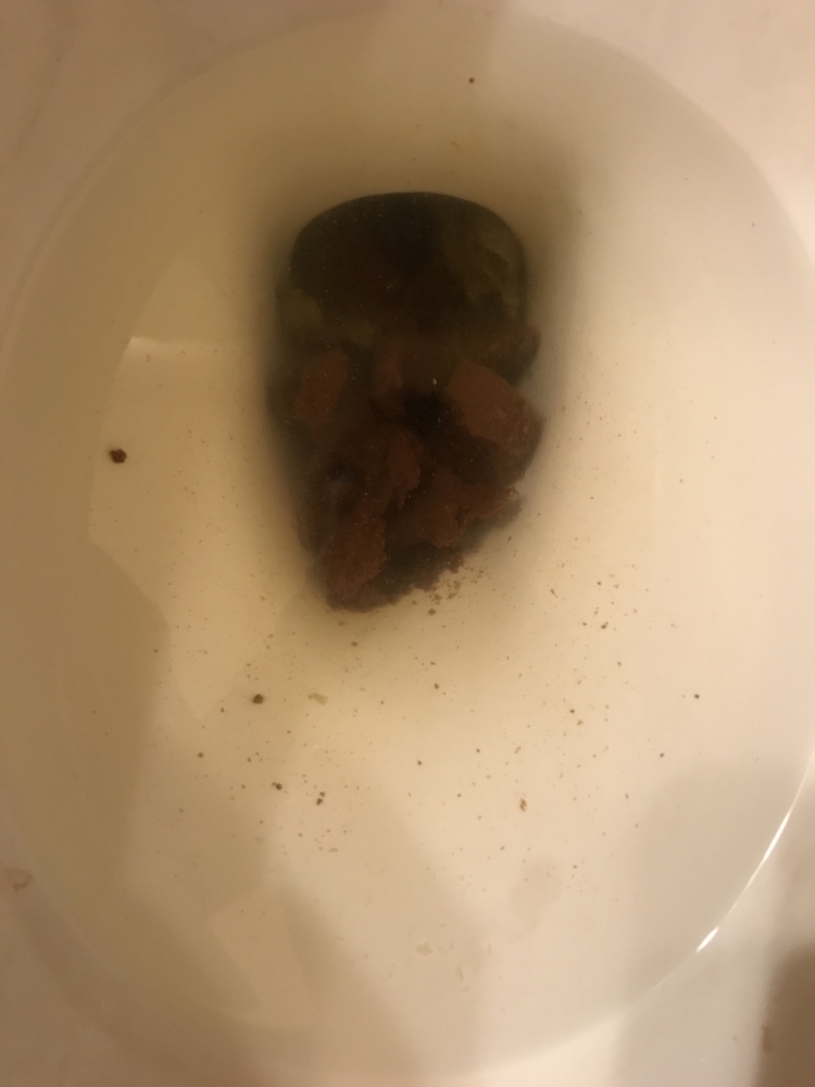 diarrhea every day but not sick