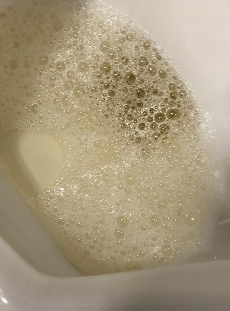 bubbles in urine