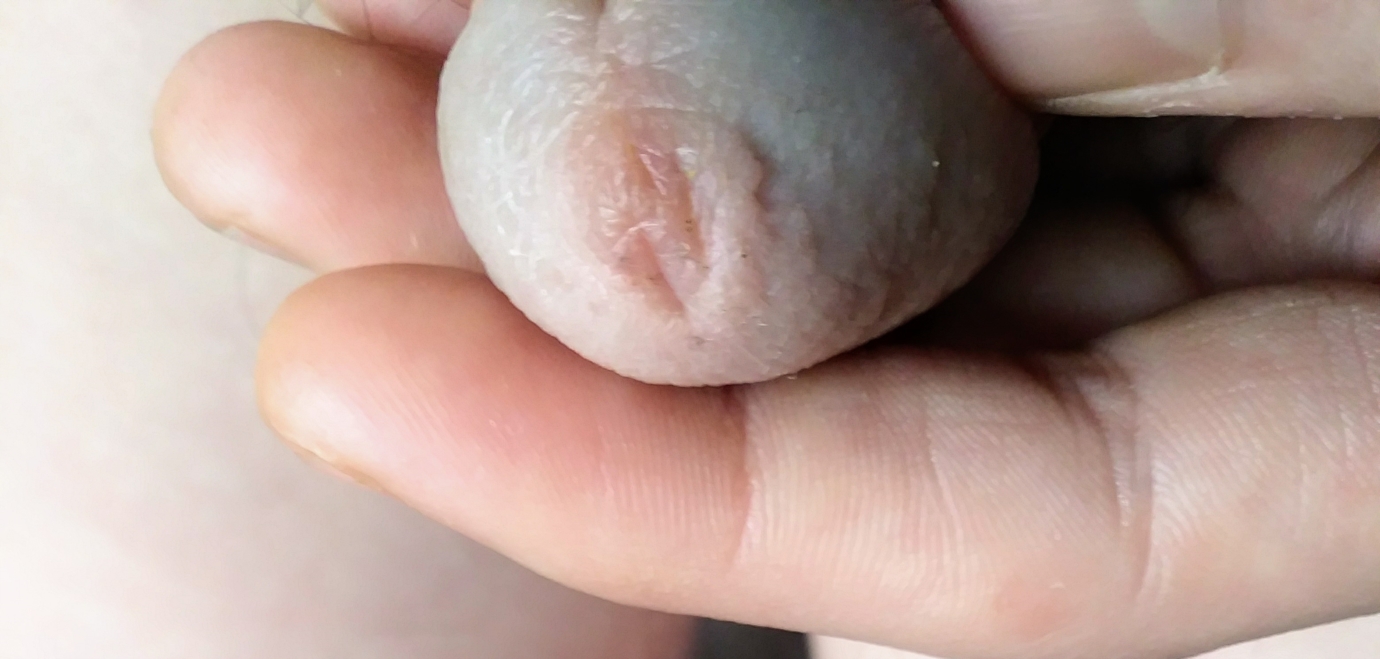 Sensitive very penis head Penis, Erection