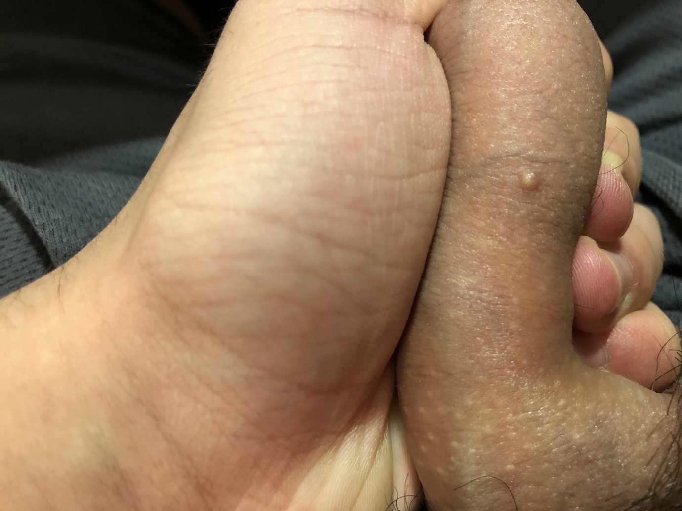 Small white bumps on shaft and balls