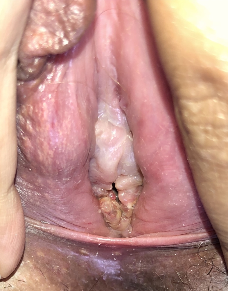 First Time In Vagina