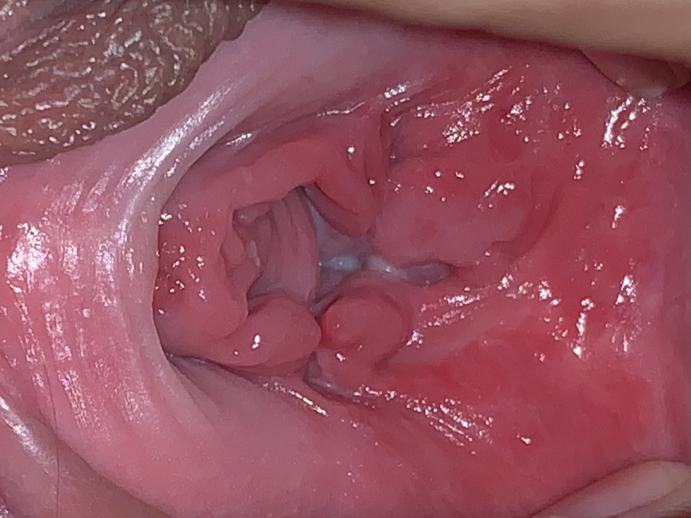 Vaginal opening pic