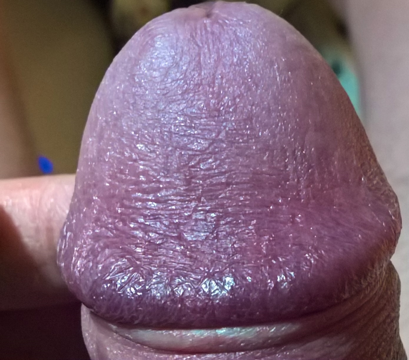 Pictures of dry skin on penis