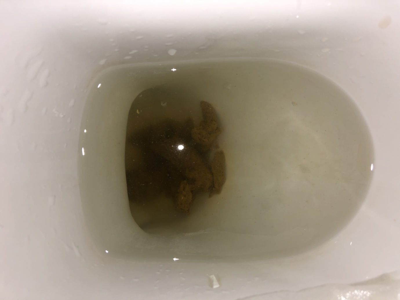pancreatic cancer poop