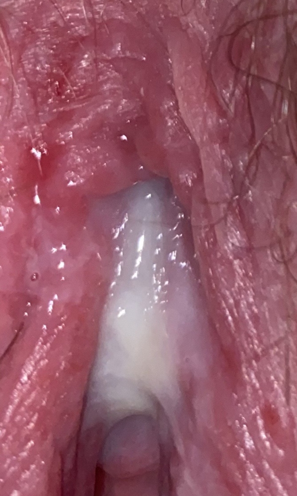 vaginal view Deep