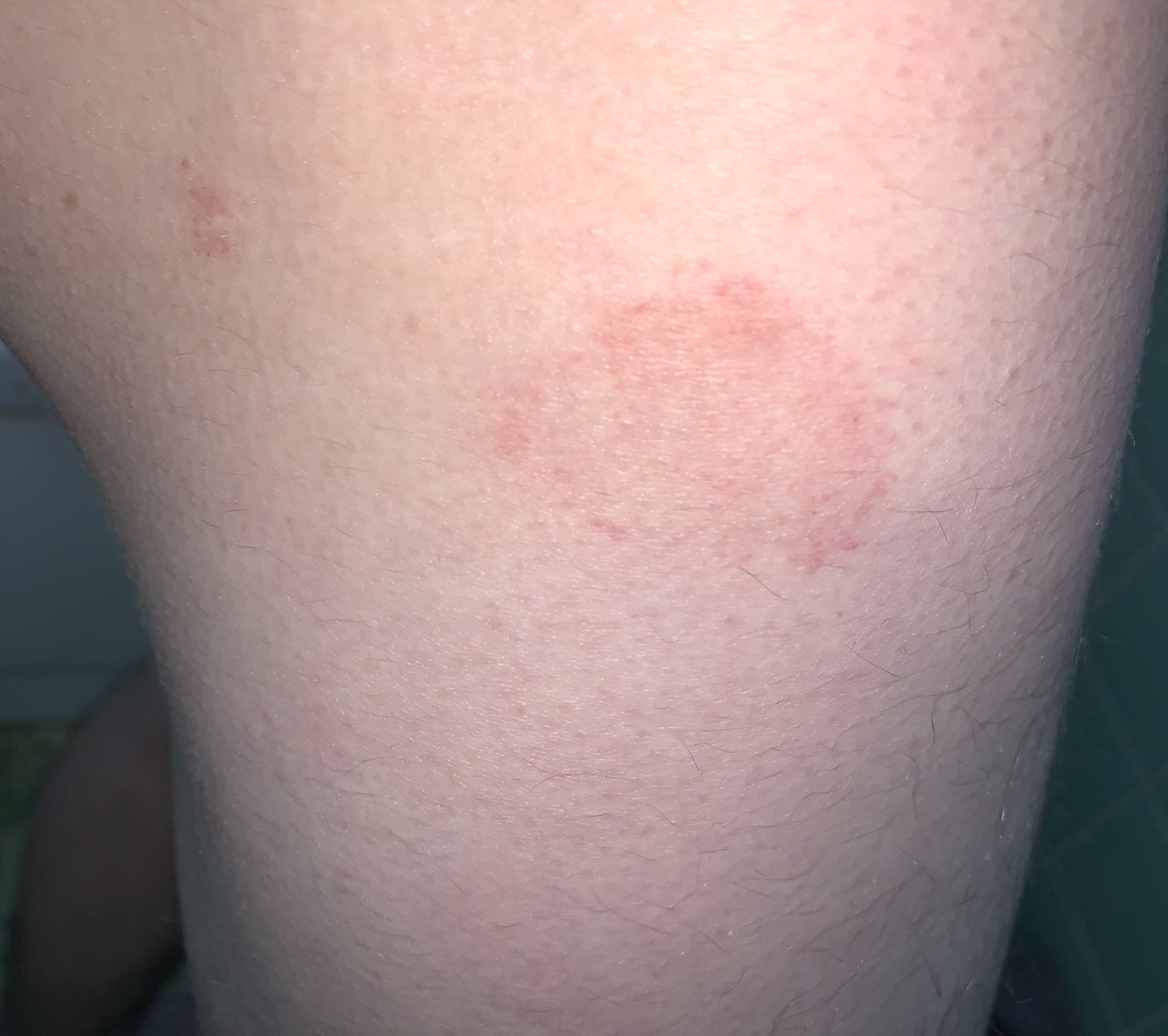 hpv and skin rash)