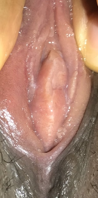 please is my vagina normal? i've never had sex before. 