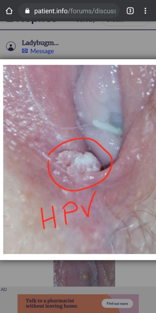 Please Help What Is This Doc Says It Is Normal But It Has