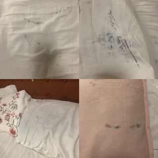 omg im having the same problem, all my sheets are getting ruined!!! the sta...