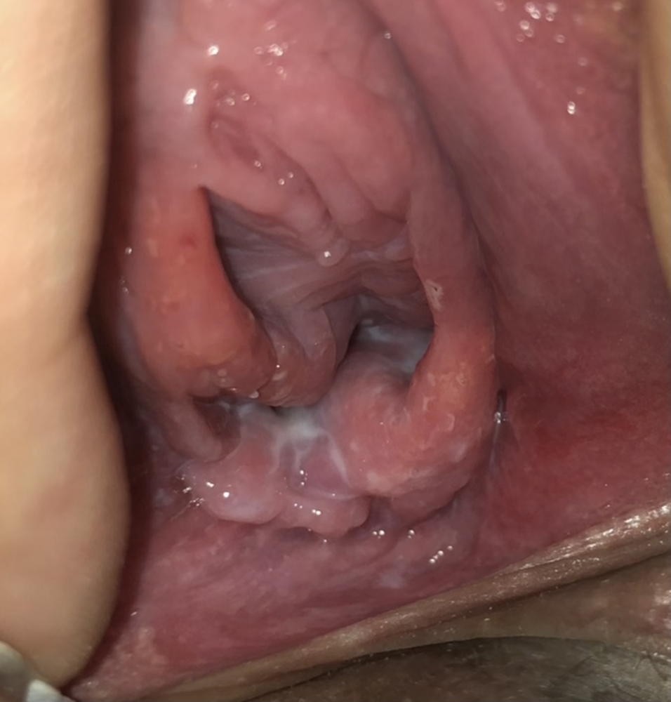 Help! Swollen vulva and spots! Sexual