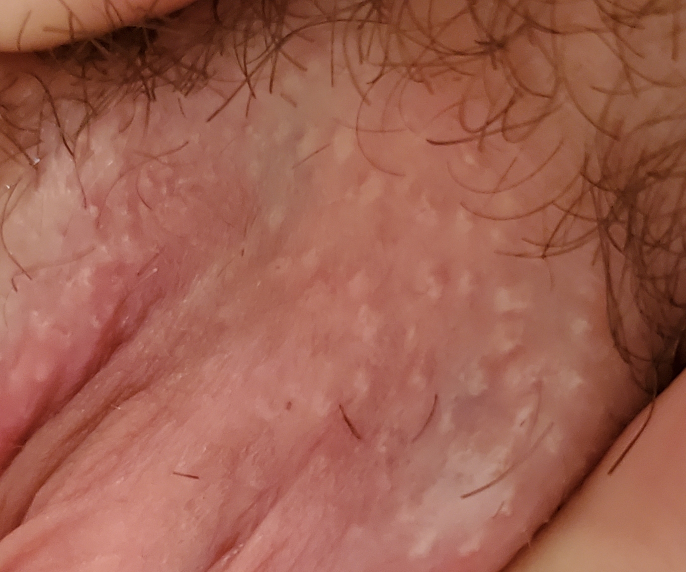 wondering if this looks like herpes? 
