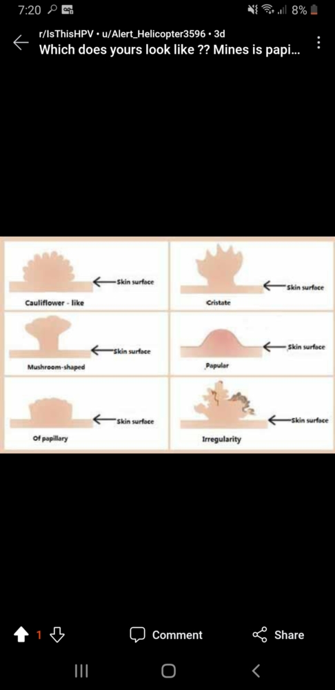 what-the-hell-are-these-bumps-vulval-problems-forums-patient