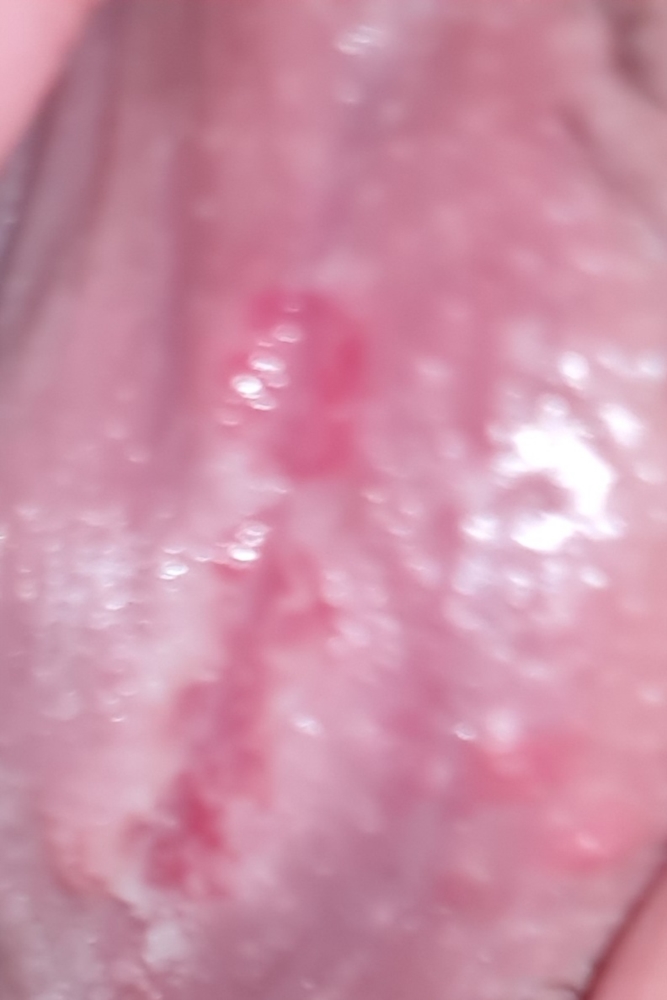 Scratched Vagina