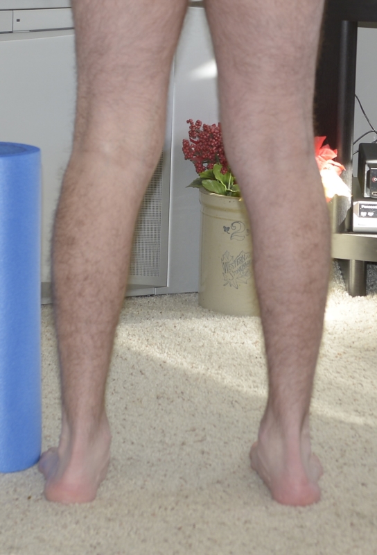 Medial Knee Pain Alignment issue? Photos included | Knee Problems
