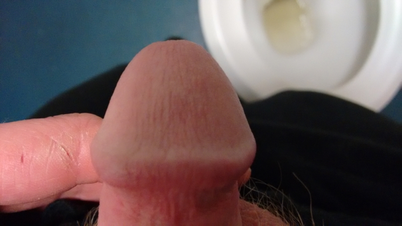 Head Of Penis 46