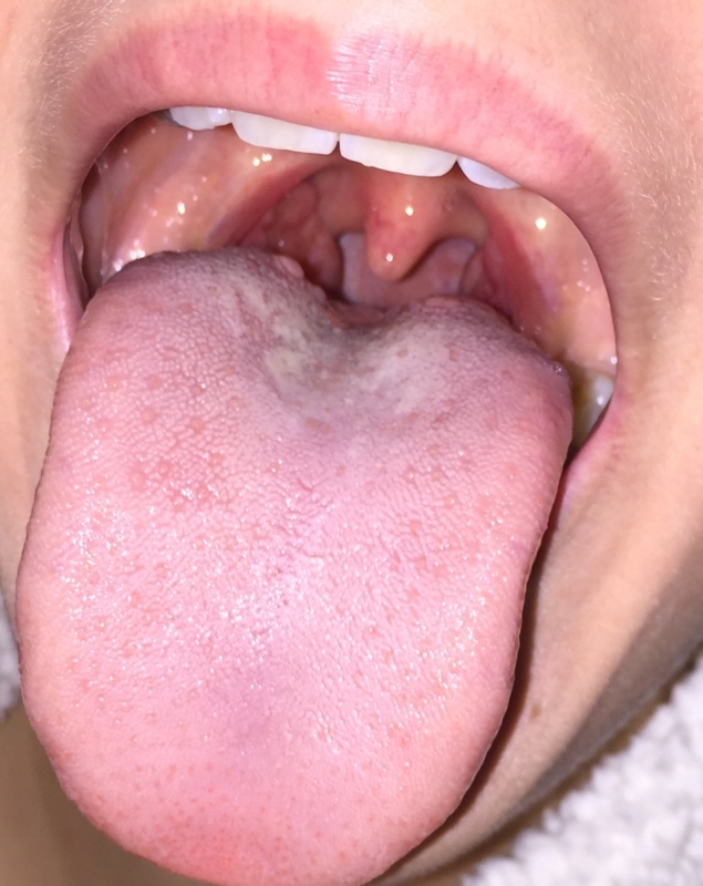 Oral Thrust 26