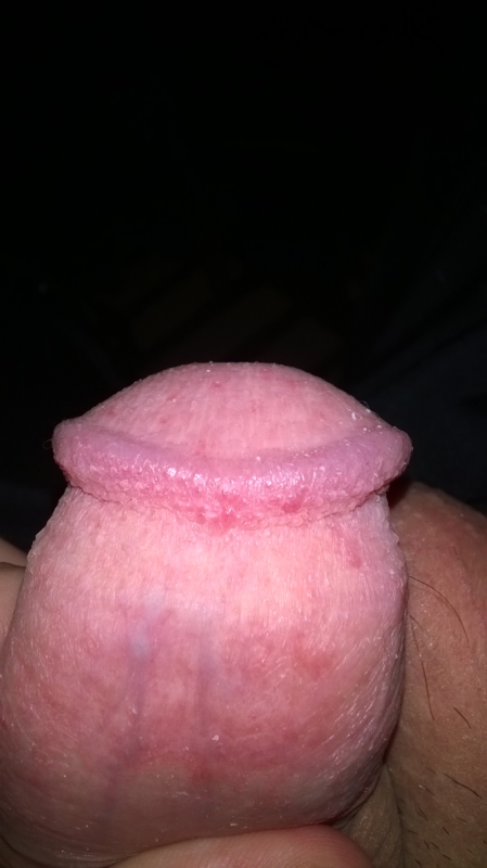 Red Penis After Sex 52