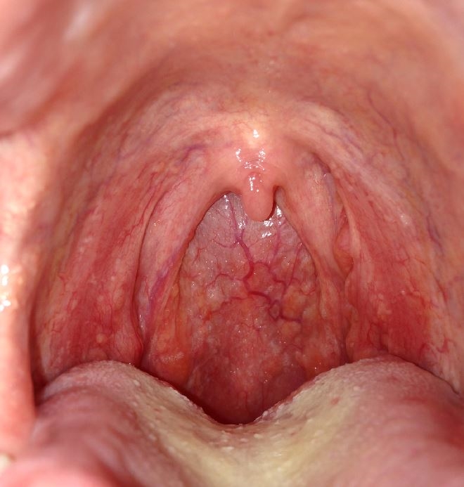 Throat Pic 42