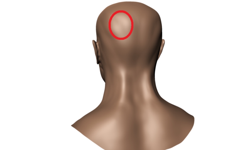 Head Pain Back Of Head Navigation Menu