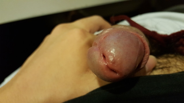 Urethra Penis 108