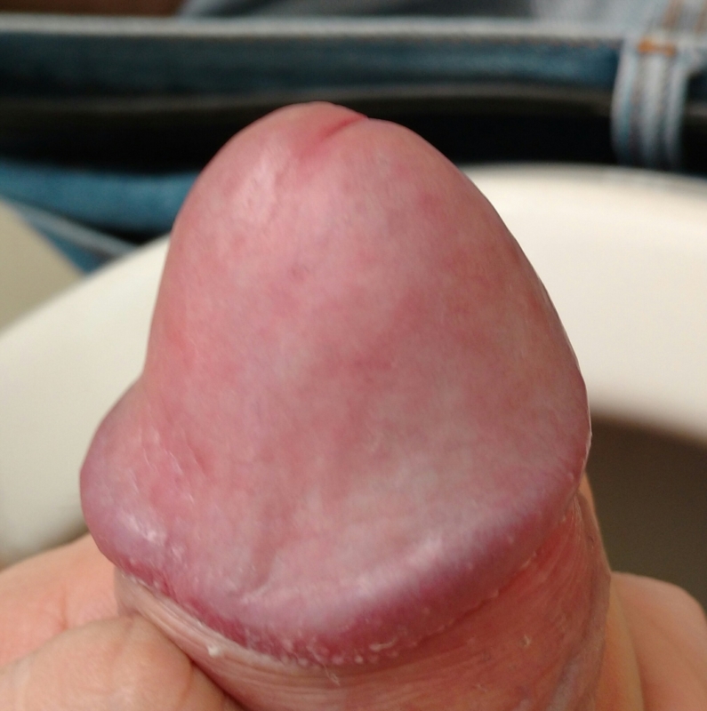 My Penis Photo 105