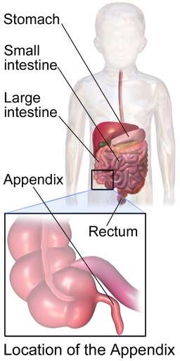 Appendix in child