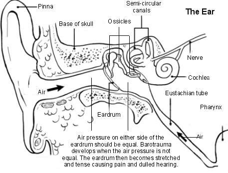 Ear - barotrauma
