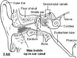 Earwax in ear canal