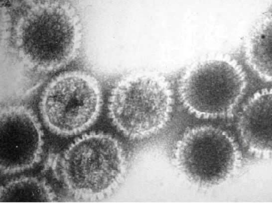 Human herpesvirus