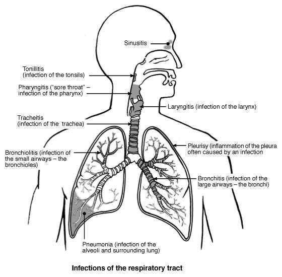 Respiratory Tract Infections | Diagram | Patient