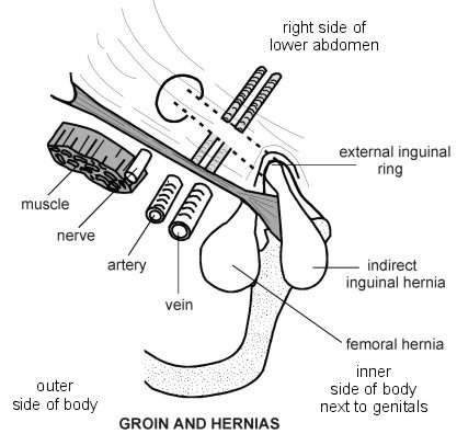 Groin and Hernias | Diagram | Patient