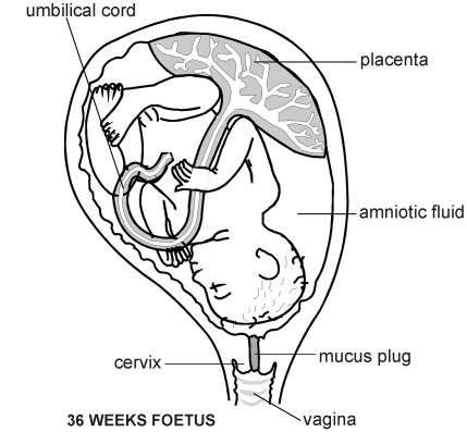 Foetus at 36 weeks | Diagram | Patient