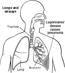 Lungs and airways - Legionnaires' disease