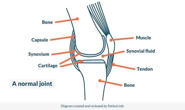 rheumatoid factor forum articulațiile piciorului doare decât să trateze