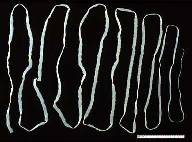 Tapeworm taenia saginata