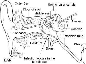 The ear showing otitis media
