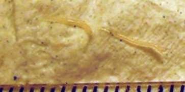 A pinworms enterobiosis, Dr. Diag - Oxyuriasis