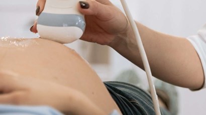 What to expect at your first ultrasound scan