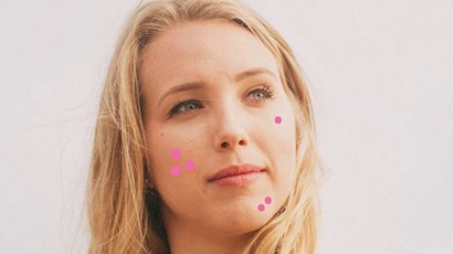 How to tell the difference between acne and other skin problems