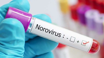 Norovirus - when to see a doctor